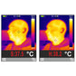 Body & Surface Thermal Imager