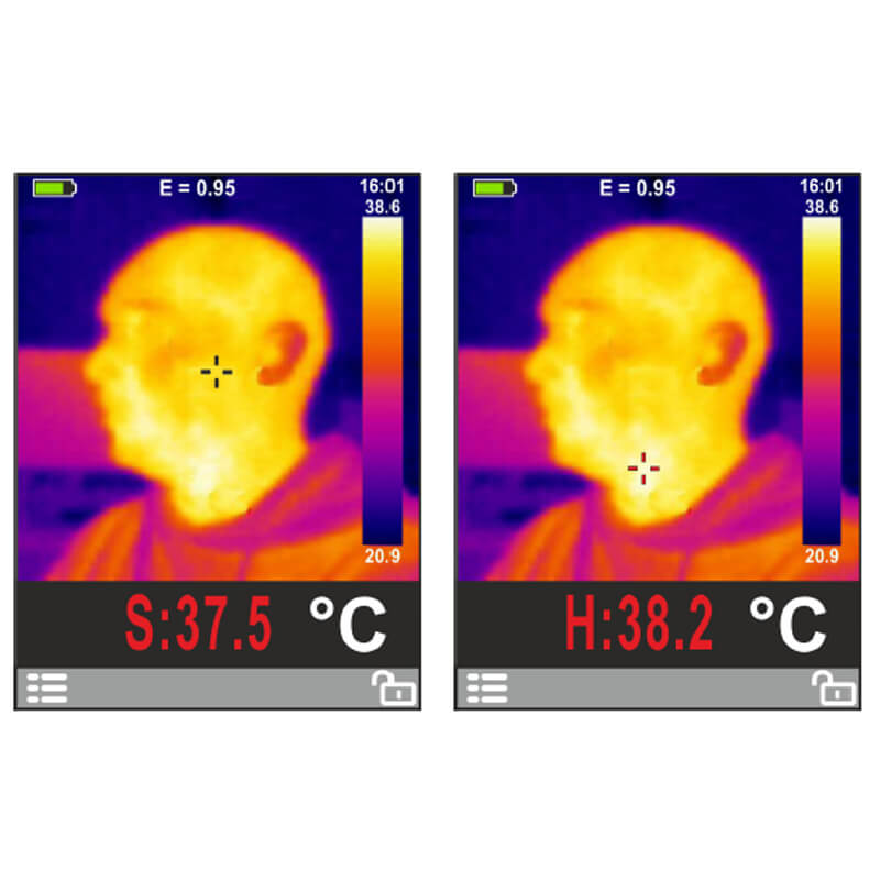 Body & Surface Thermal Imager